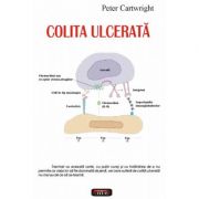 Colita ulcerata – Peter Cartwright librariadelfin.ro
