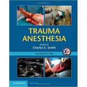 Trauma Anesthesia – Charles E. Smith librariadelfin.ro imagine 2022 cartile.ro