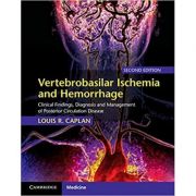 Vertebrobasilar Ischemia and Hemorrhage: Clinical Findings, Diagnosis and Management of Posterior Circulation Disease – Louis R. Caplan librariadelfin.ro imagine noua