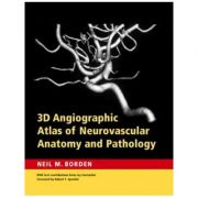 3D Angiographic Atlas of Neurovascular Anatomy and Pathology – Neil M. Borden MD librariadelfin.ro imagine 2022 cartile.ro
