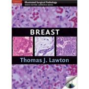 Breast – Thomas J. Lawton MD La Reducere de la librariadelfin.ro imagine 2021