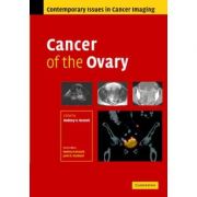 Cancer of the Ovary – Rodney Reznek Carte straina. Carti medicale imagine 2022