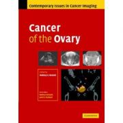 Cancer of the Ovary - Rodney Reznek