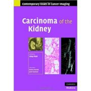 Carcinoma of the Kidney – Uday Patel Carte straina. Carti medicale imagine 2022