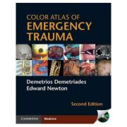Color Atlas of Emergency Trauma – Demetrios Demetriades, Edward Newton