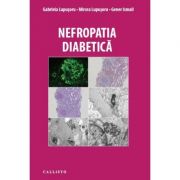 Nefropatia Diabetica – Gabriela Lupusoru, Mircea Lupusoru, Gener Ismail Cărți