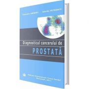 Diagnosticul cancerului de prostata – Valentin Ambert librariadelfin.ro poza 2022