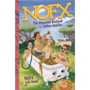 NOFX: The Hepatitis Bathtub and Other Stories – Nofx, Jeff Alulis librariadelfin.ro imagine 2022