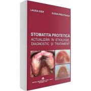 Stomatita protetica. Actualizari in etiologie, diagnostic si tratament – Laura Iosif Medicina ( Carti de specialitate ). Stomatologie imagine 2022
