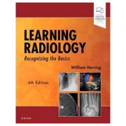 Learning Radiology: Recognizing the Basics – William Herring Carte straina. Carti medicale imagine 2022