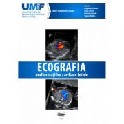 Ecografia Malformatiilor Cardiace Fetale. Brosura + DVD – Claudiu Marginean librariadelfin.ro poza 2022