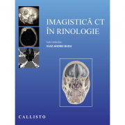 Imagistica CT in rinologie – Vlad Andrei Budu librariadelfin.ro poza noua