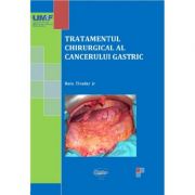 Tratamentul chirurgical al cancerului gastric. Alb-negru – Bara Tivadar jr librariadelfin.ro