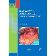 Tratamentul chirurgical al cancerului gastric. alb-negru - bara tivadar jr