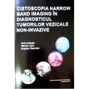 Cistoscopia narrow band imaging in diagnosticul tumorilor vezicale non-invazive – Marian Jecu, Bogdan Geavlete librariadelfin.ro imagine 2022