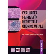Evaluarea fibrozei in hepatitele cronice virale – George Sebastian Gherlan Cărți