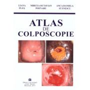 Atlas de colposcopie – Liana Ples, Mircea Octavian Poenaru, Anca Daniela Stanescu librariadelfin.ro imagine 2022