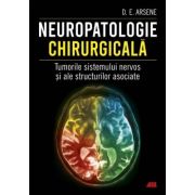 Neuropatologie chirurgicala. Tumorile sistemului nervos si ale structurilor asociate - Dr. Dorel Eugen Arsene