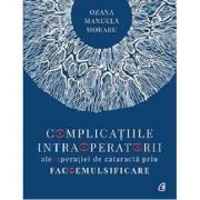 Complicatiile intraoperatorii ale operatiei de cataracta prin facoemulsificare - Dr. Ozana Moraru
