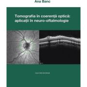 Tomografia in coerenta optica: aplicatii in neuro-oftalmologie - Ana Banc