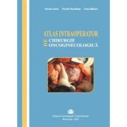 Atlas intraoperator de chirurgie oncoginecologica - nicolae suciu