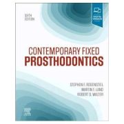 Contemporary Fixed Prosthodontics – Stephen F. Rosenstiel, Martin F. Land carte